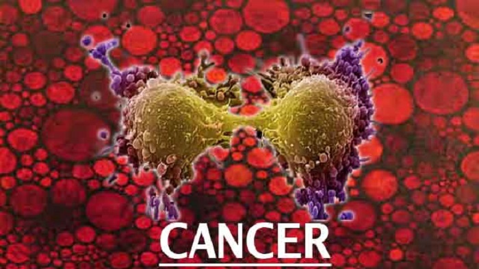 Study: U.S. cancer deaths are mostly preventable